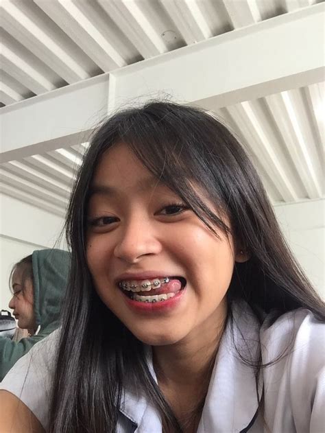 'pinay braces' Search .